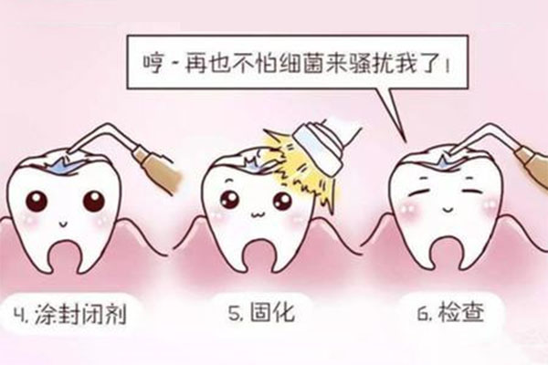 儿童多大做窝沟封闭好(儿童多大做窝
