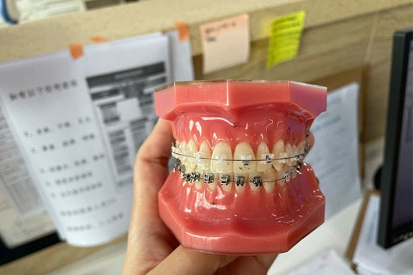 正畸 中线对齐(正畸中线对齐了但却不跟面部中线对齐)