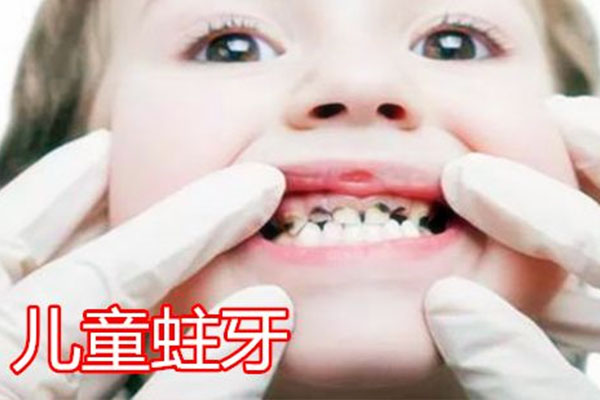 两岁多的小孩蛀牙怎么办(两岁多的小孩蛀牙怎么办图片)